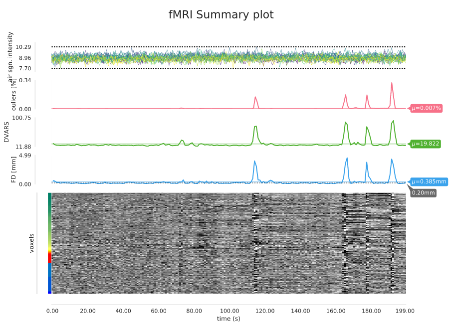 fMRI summary plot